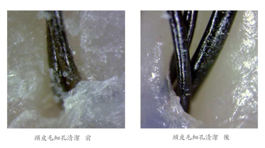 毛穴清潔前後